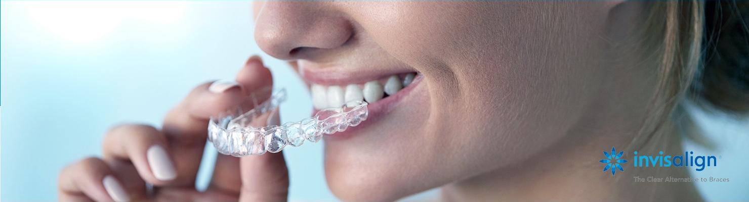 Invisalign®